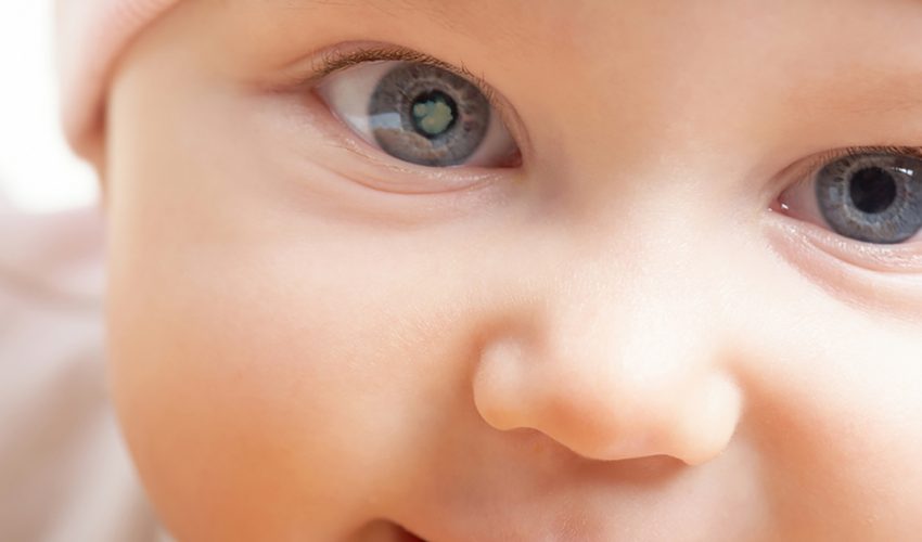 child-cataract