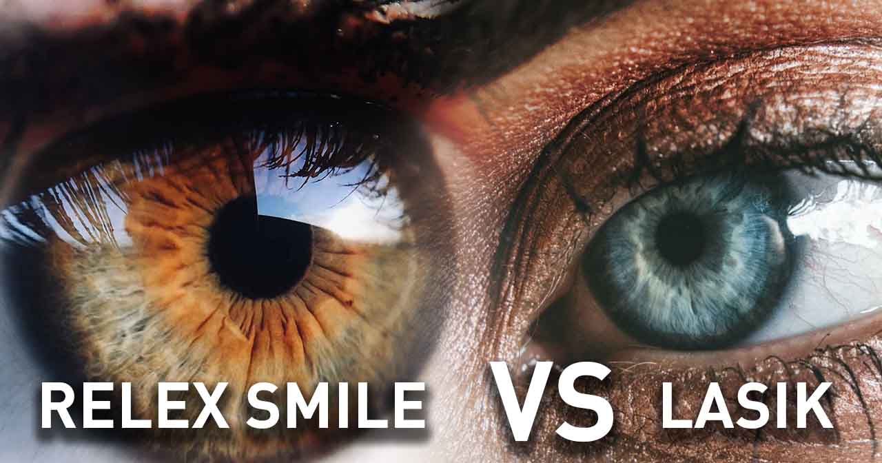 relex smile vs lasik